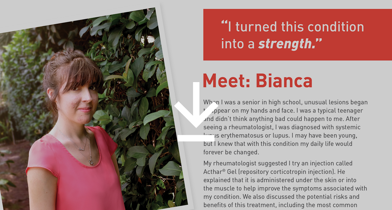 Meet Bianca, who treated her systemic lupus erythematosus with Acthar Gel