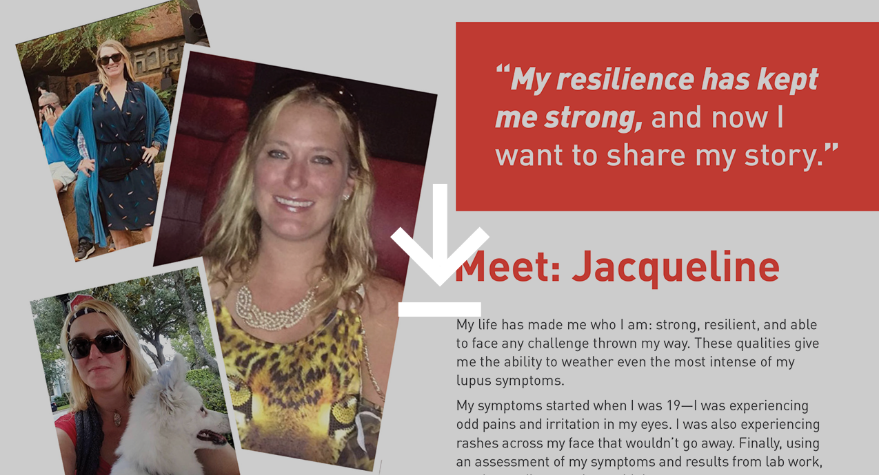 Meet Jacqueline, who treated her systemic lupus erythematosus with Acthar Gel