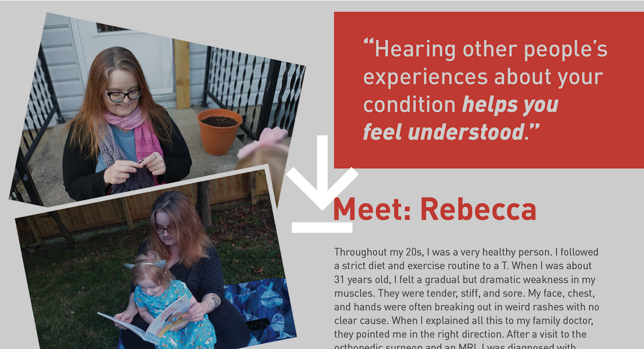 Meet Rebecca, who treated her dermatomyositis with Acthar Gel